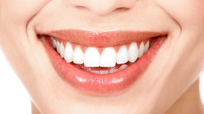Dental Implants Image