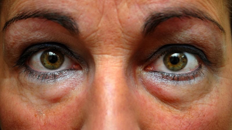 closeup of senior woman's eyes, for article on "My thoughts – I go wherever I go"